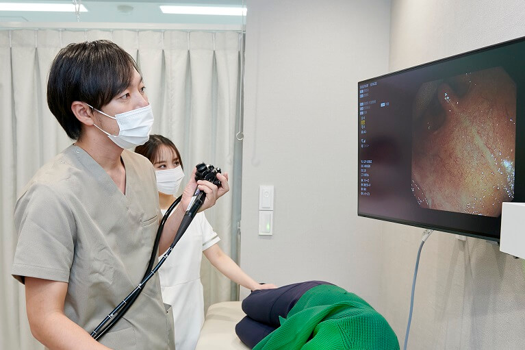 胃カメラ(胃内視鏡検査)